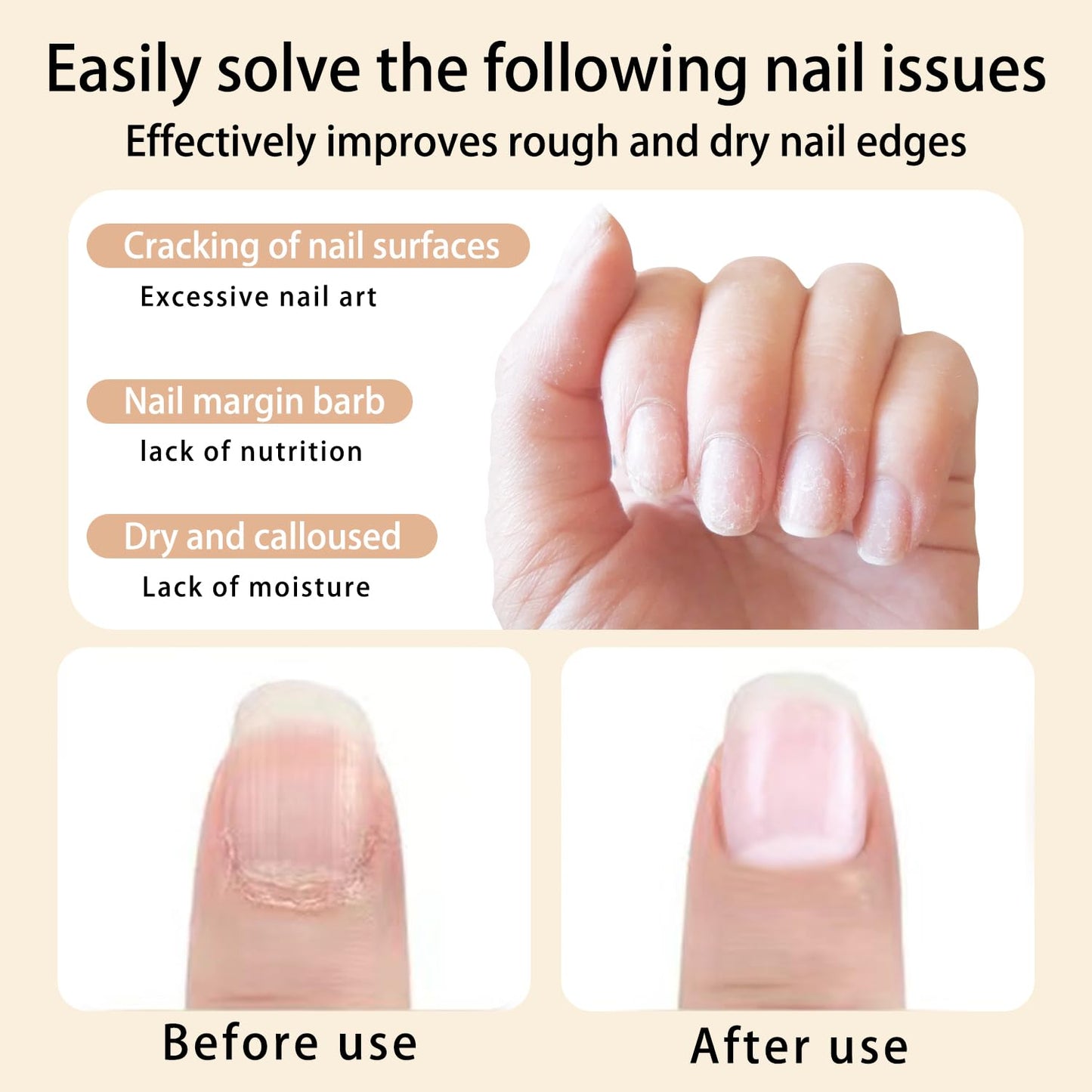 28PCS Cuticle Oil Pen Sweet Almond Nail Growth Serum and Repair Treatment Hydrating Oil for Dry Cuticles and Skin Cuticle Buddy Revitalize Nails with Radiant Cosmetics' Nail Growth Oil