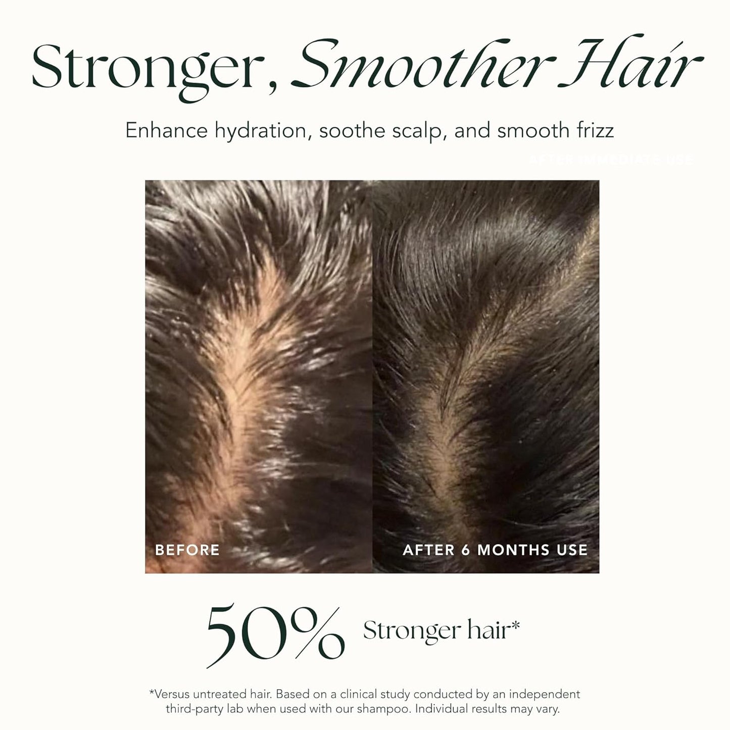 RANAVAT Mighty Majesty - Fortifying Hair Serum - Hair Oil Serum for Scalp Hydration, Frizz Control, & Hair Shine - With Jasmine and Amla Extract (1.7 oz)