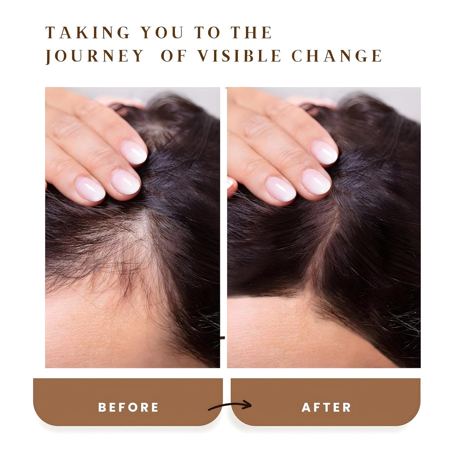 Rosemary Revival Oil Organic – Nourishing Hair & Scalp Oil – Hydrating Botanical Blend with Vitamin E – Conditions, Softens & Adds Shine – Hair Serum for Dry or Damaged Hair – 1.7oz – The Oily Tonic