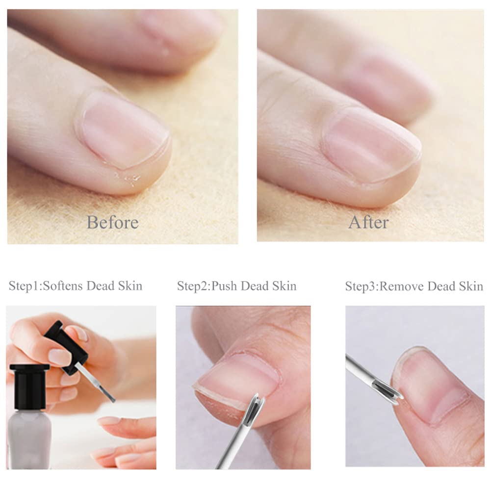 9 Pack Cuticle Nail Pusher and Trimmer Nail Cuticle Fork Professional Stainless Steel Dead Skin Remover Dead Skin Cuticle Pusher Nail Art Tool for Fingernails and Toenails