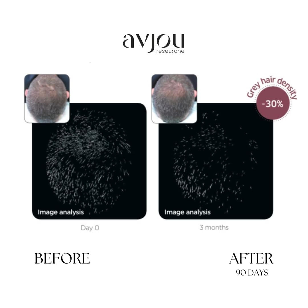 Avjou Researche™ Scalp Serum – Thicker, Fuller-Looking Hair + Targets Visible Signs of Premature Greying – 3 Patented Ingredients – Backed by Cosmetic Science – Oil-Free, All Hair Types, 1.7 oz