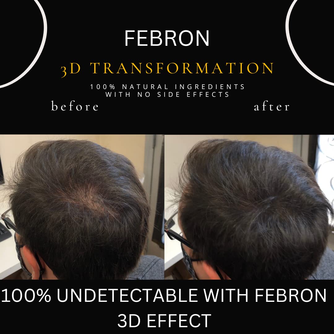 FEBRON Hair Fibers For Thinning Hair MEDIUM BROWN Giant 30G For Women & Men Hair Loss Concealer Hair Powder Volumizing Based 100% Undetectable & Natural - Bold Spots Filler