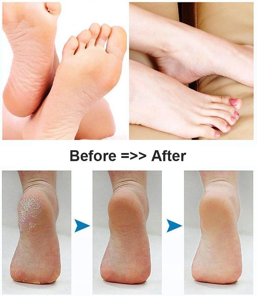 BOMPOW Electric Foot Scrubber Foot File Hard Skin Remover Pedicure Tools Electronic Callus kit for Cracked Heels and Dead Skin with 2 Roller Heads, White