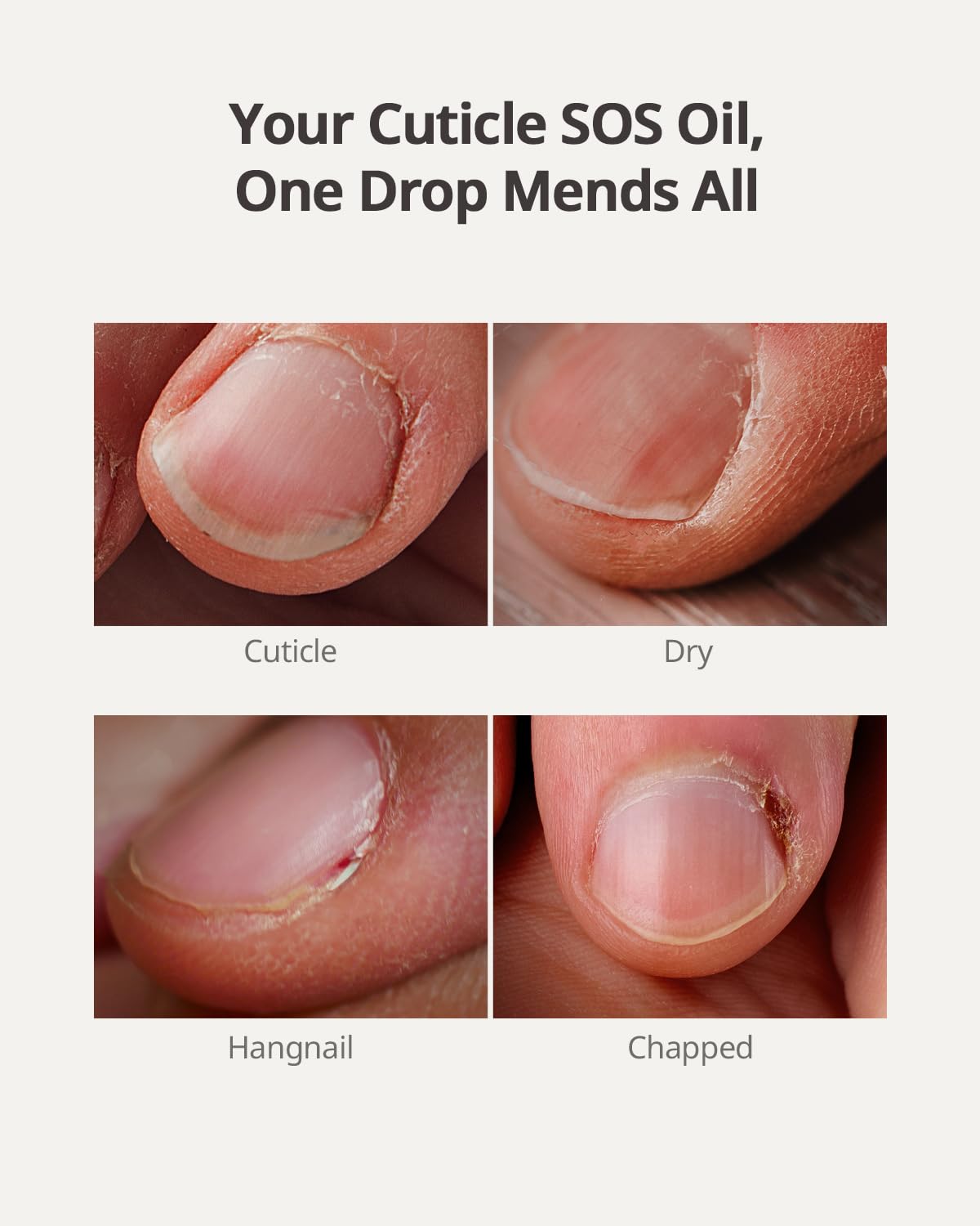 BTARTBOXNAILS Cuticle Oil - Essential Cuticle Oil to Moisturize & Condition with Jojobal Oil, Vitamin E, Biotin, Squalane, Oil-Water Dual Phase Nourishing Treatment for Daily Cuticle Care, 15ml