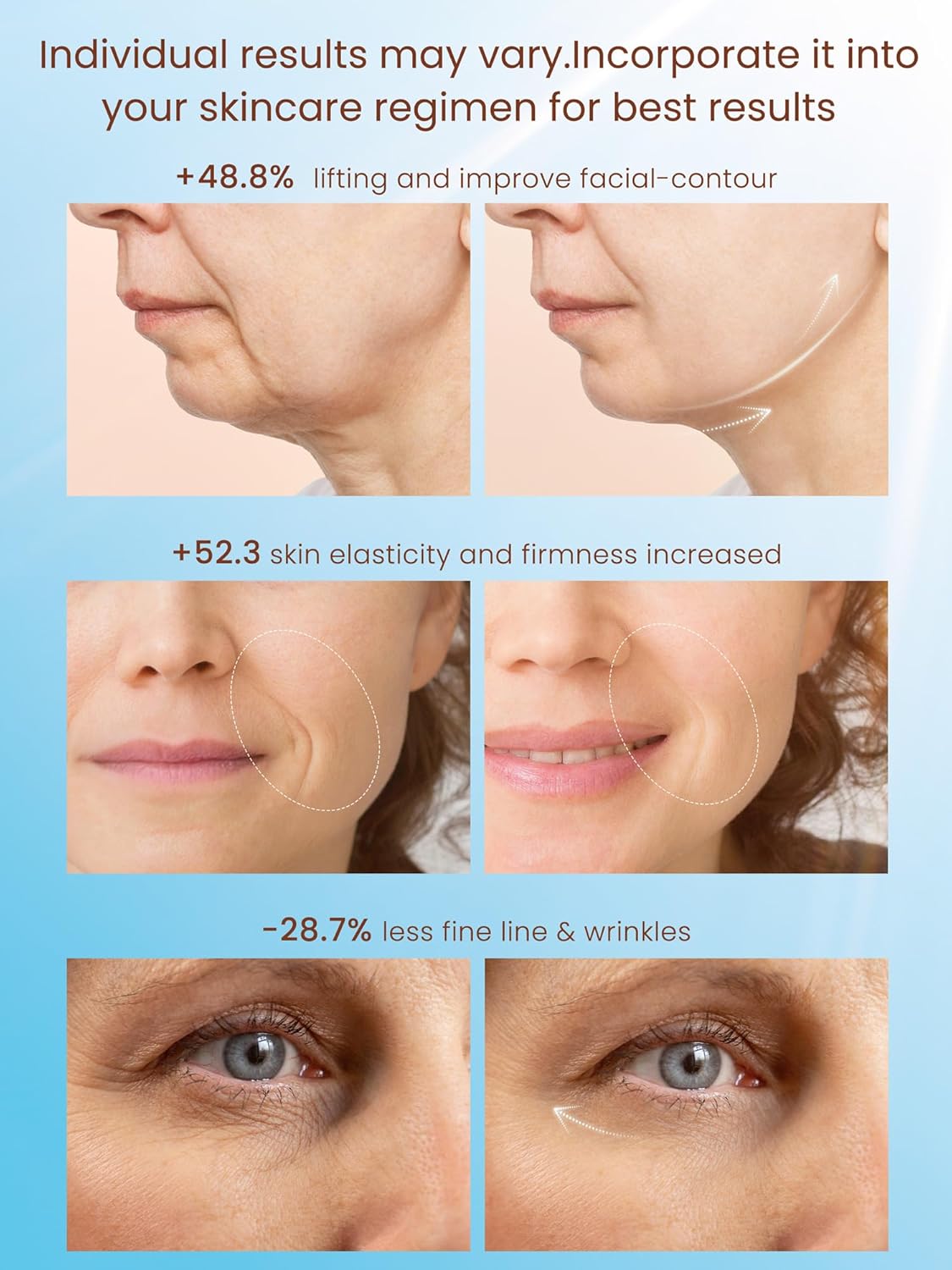 Radio Frequency Skin Tightening Device, Smart Electric Zinc Alloy Facial Beauty Machine with RF-Current Cold Heat for Jawline Lifting, Cheek Firm, Wrinkle Reduction, Depuff, Increase Absorption