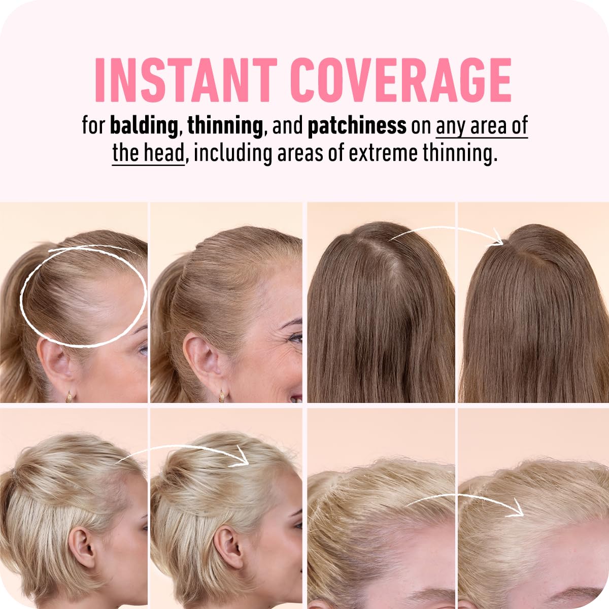 BOLDIFY Hairline Powder (LARGE, 10g) - Root Touch Up Hair Color for Gray Coverage - Bald Spot Concealing Hair Powder for Women & Men - 48-Hour Stain-Proof - Dark Blonde