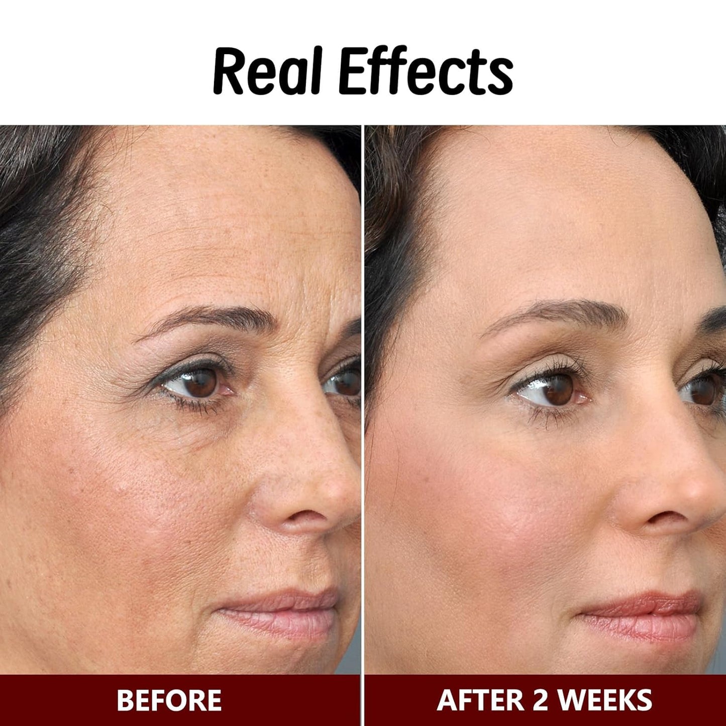 Bee Venom Skin Treatment Cream, Bee Venom Comprehensive Cream, Face lifting and firming, Effective In Reducing Skin Blemishes, Gentle and Non-irritating, Suitable For All Parts 2.1 Ounce (Pack of 1)