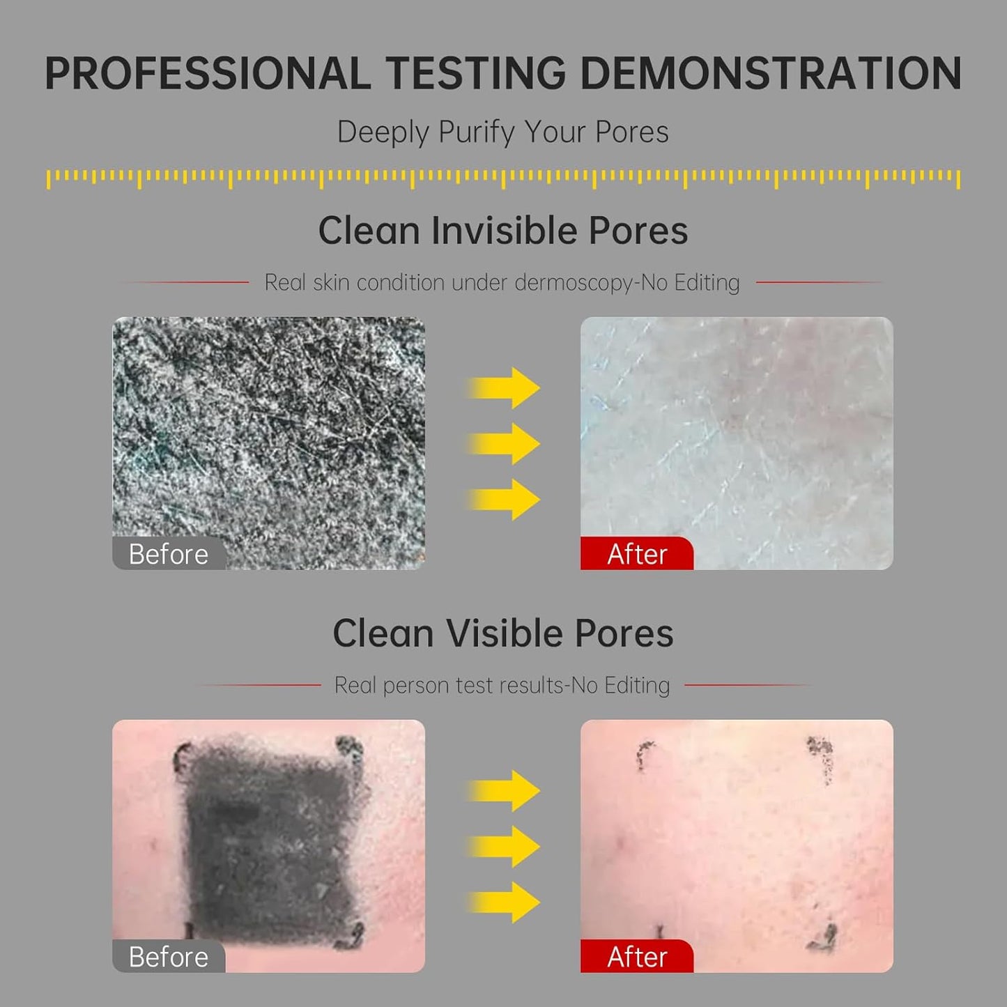 Gentle Exfoliating Face Wash for Deep Pore Cleanser and Blackhead Removal, Facial Cleanser for Oily Skin & Sensitive Skin, Double Cleansing Daily Facial Wash with Hyaluronic Acid + Glycerin, 2 Pack