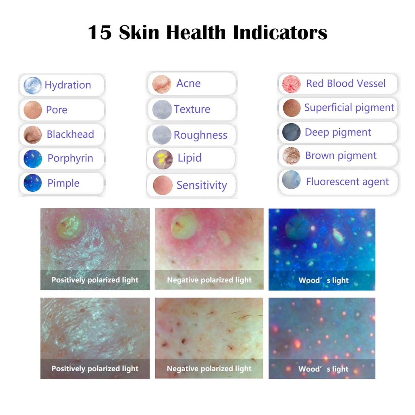 Facial Skin Analysis Machine Professional - 15.6" Scanner for Pores, Acne, Hydration; Customizable Reports; For Estheticians & Spas; 8-Spectrum Imaging; Multi-Language