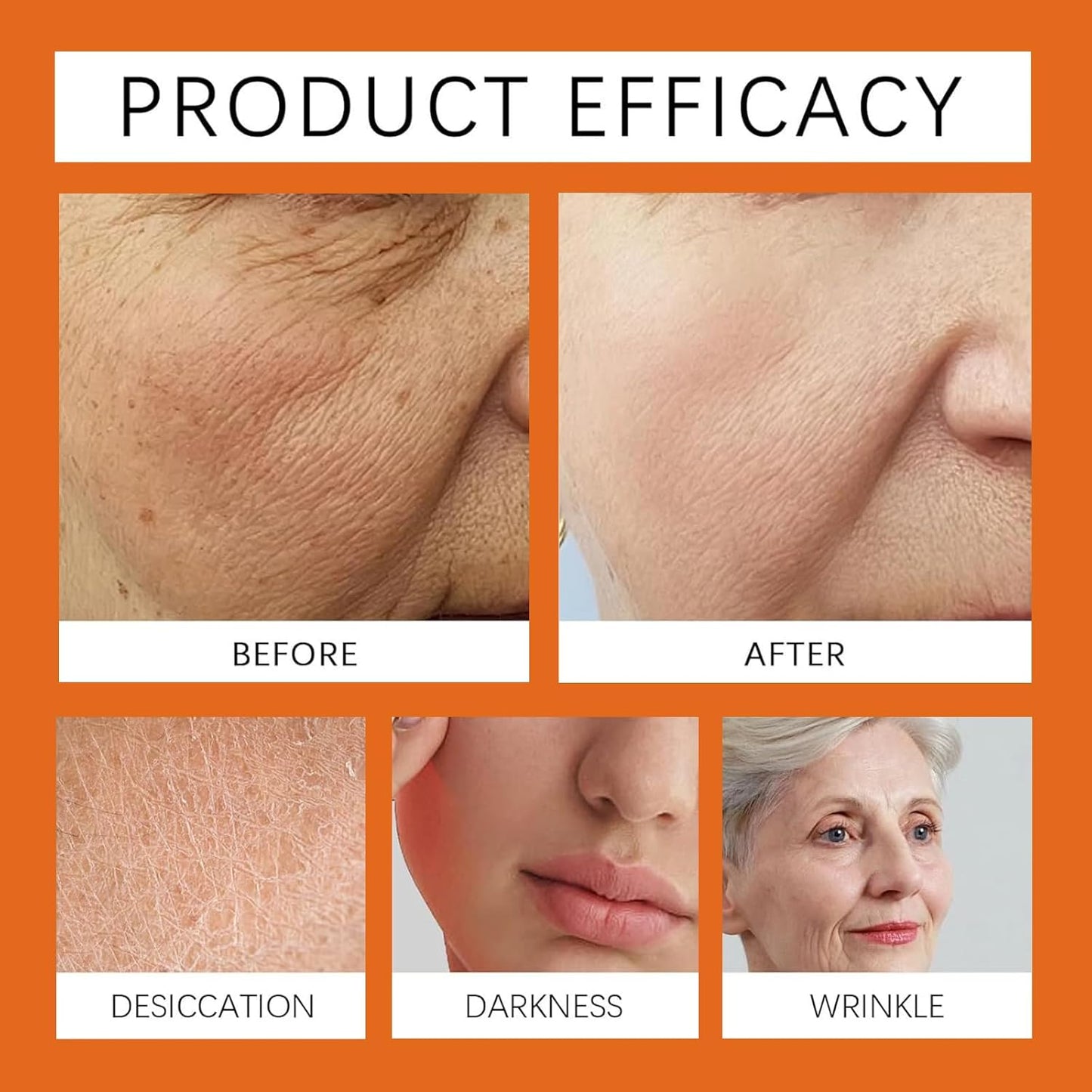 Bee Venom Comprehensive Cream, Professional bee venom cream for Removing and Repair, APKAPK Bee Venom Skin Treatment Cream, Natural Serum Suitable for All Skin Types (3 Pack)