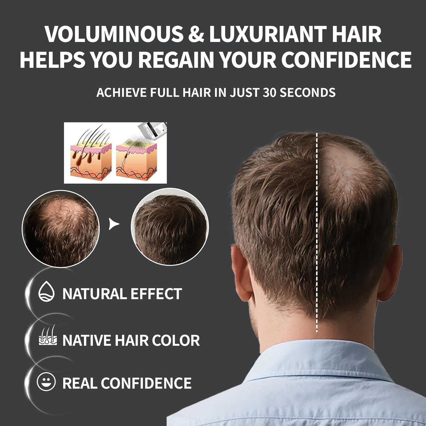 Hair Building Fibers Refill Pack - 100g Instant Thickening Fibers for Men & Women, Natural Cotton Powder, Wind/Rain Resistant, For All Hair Fiber Applicator Bottles (Black)