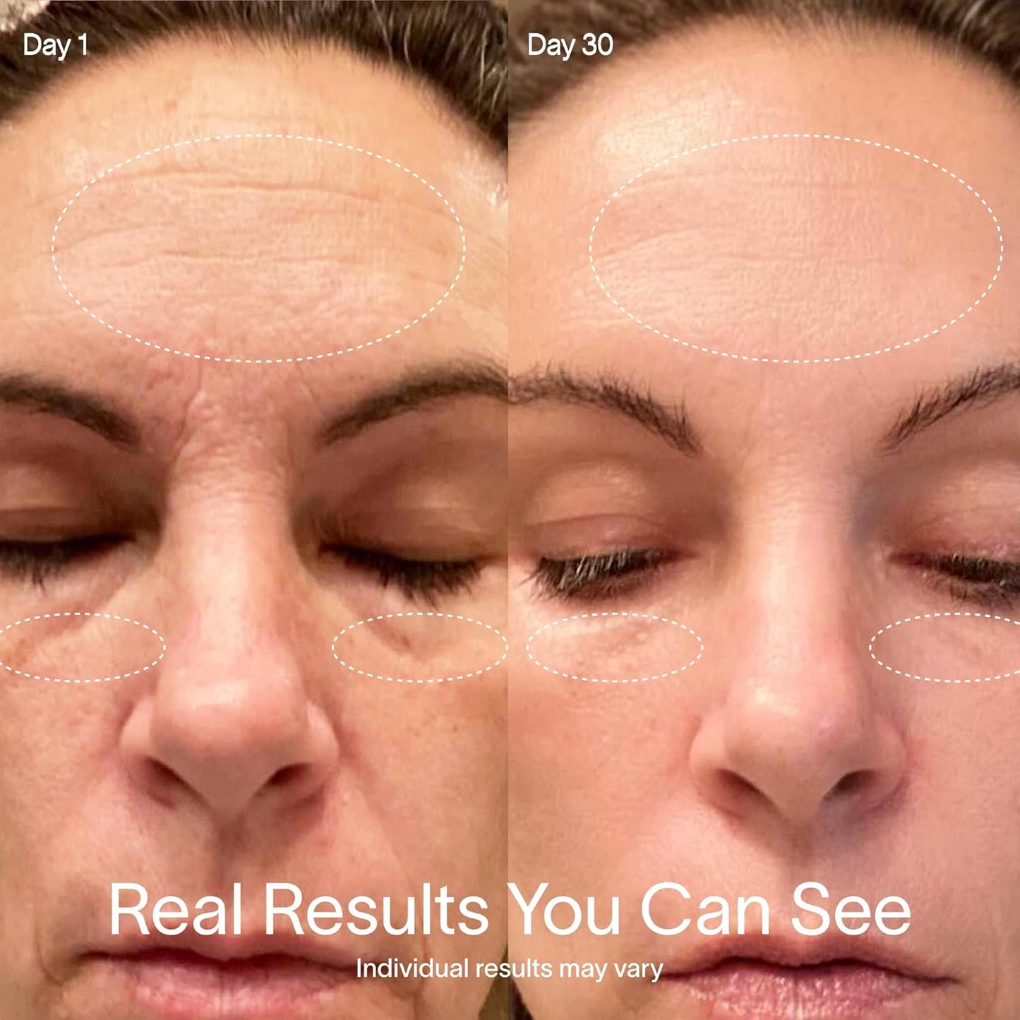 Solawave 4-in-1 Red Light Therapy Wand for Face & Neck | Beauty Device with Galvanic Current, Massager & Warmth | Anti-Aging, Wrinkle Reduction, Skin Tightening, Depuffing & Rejuvenation (Rose Gold)