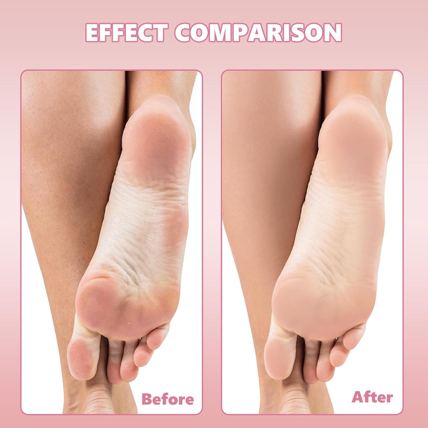 Flutesan 80 Pcs Stainless Steel Foot File Refills 100 Grit Replacement Pads Coarse Fine Pedicure File Refills Double Side Reusable Foot Rasp Pad with Removable Glue