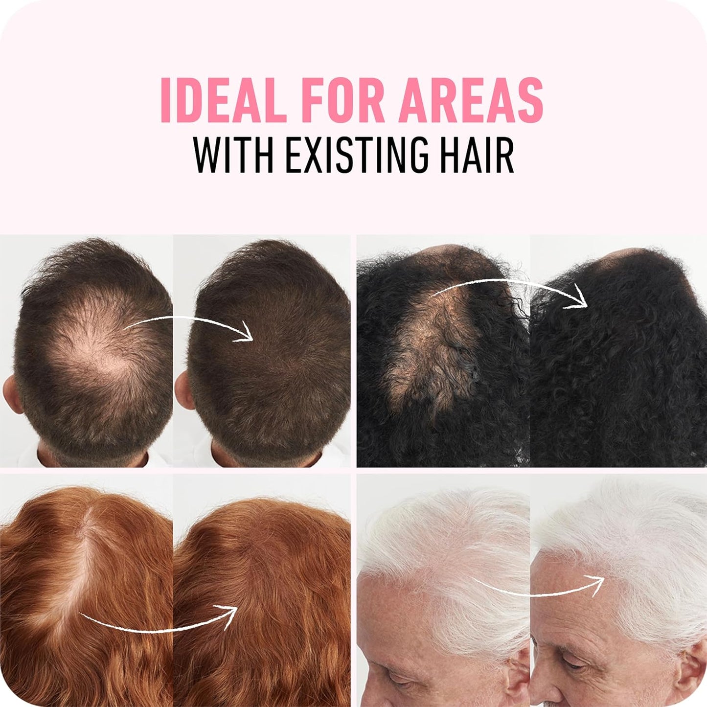 BOLDIFY Hair Fibers (56g) - Fill In Thinning and Fine Hair for an Instantly Fuller, Thicker Look - 14 Shades for Women & Men - White