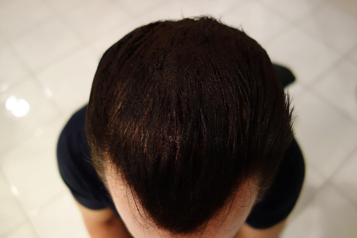 Hair Building Fibers 200 Grams 7 Oz. With Bottle By Finally Hair 50g*4 (Medium Blond (light medium blond))