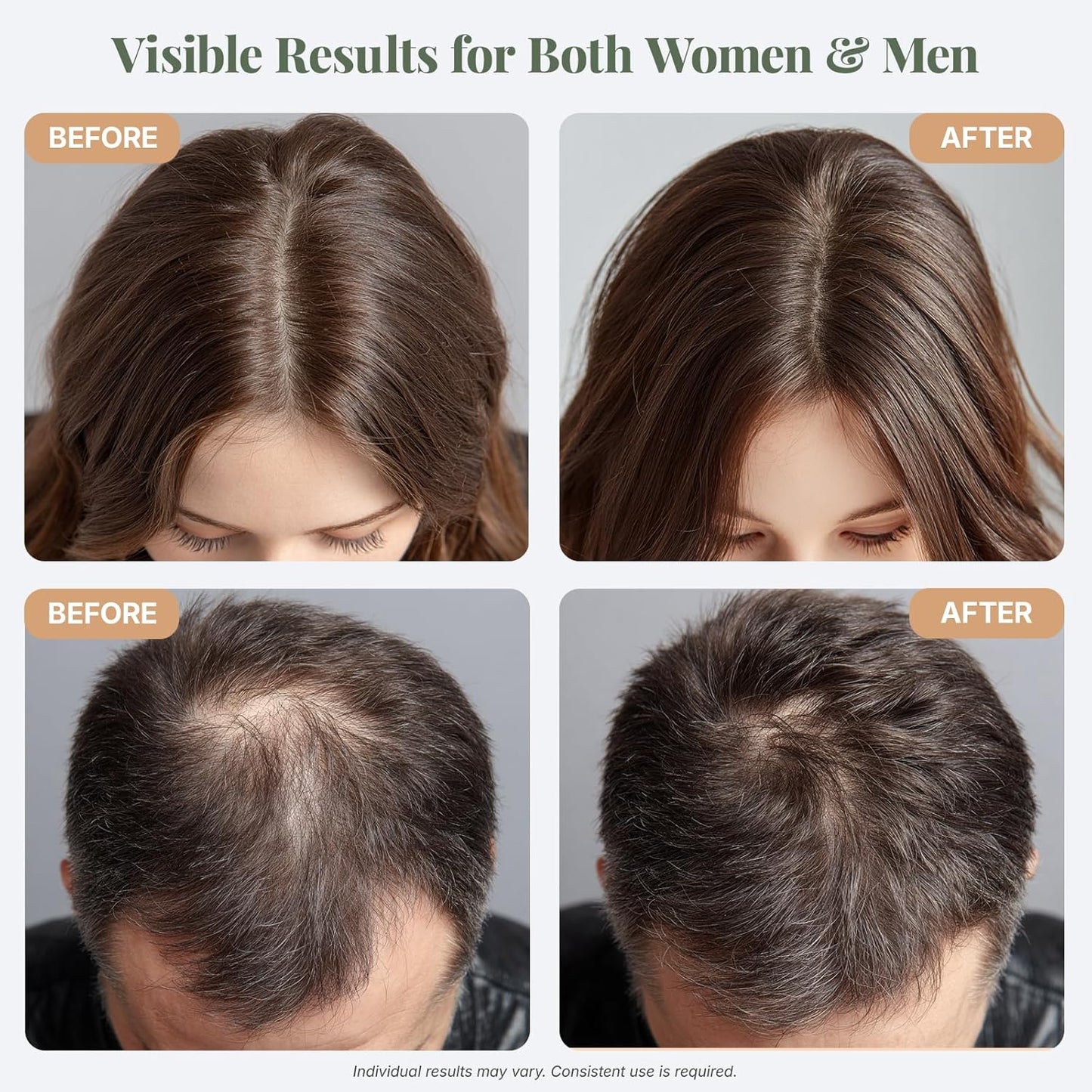 The ÉLIX USDA Organic Rosemary Oil for Hair Growth | Thickening Formula with Castor & Pumpkin Seed | for Hair Loss & Thinning | Made in USA | 4oz