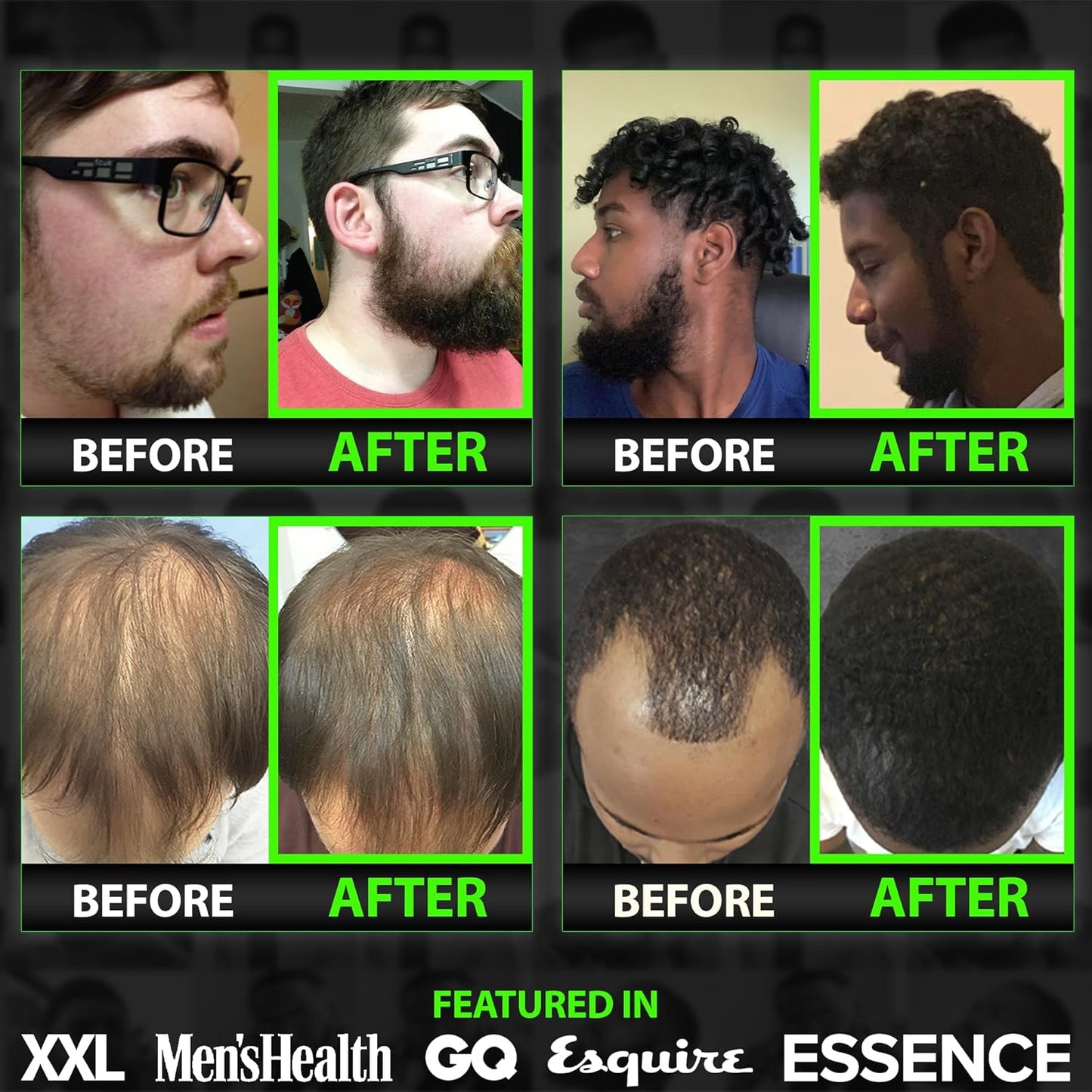 Beard Growth Kit w/GROW Beard Growth Oil for Men + 2X Thickening Biotin Beard Balm/Beard Care & Beard Conditioner (Beard Kit for Facial Hair Growth)