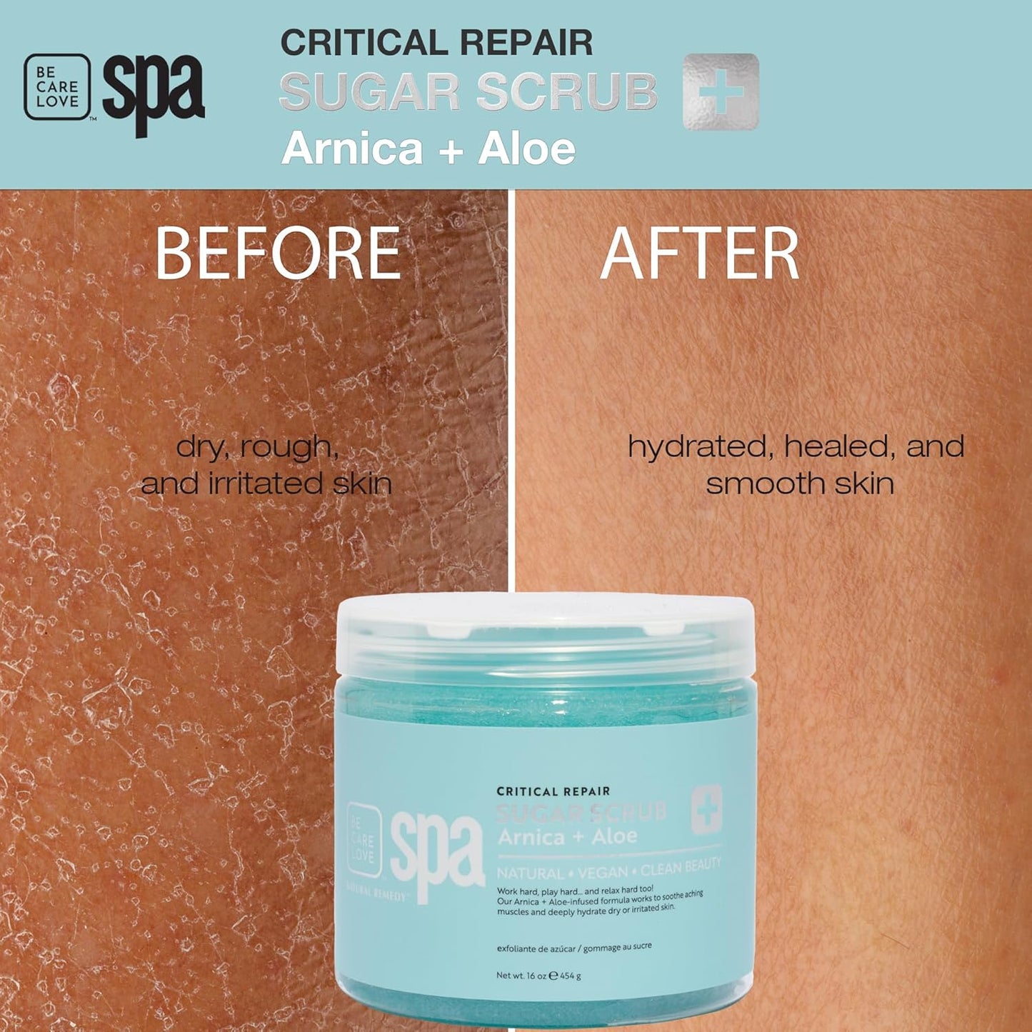 BCL Spa Critical Repair organic sugar scrub with Arnica and Aloe Vera, Hydrating & Exfoliating Body Scrub, Soothing & Nourishing organic botanical extracts & oils for hands, body, and foot spa, 16 oz