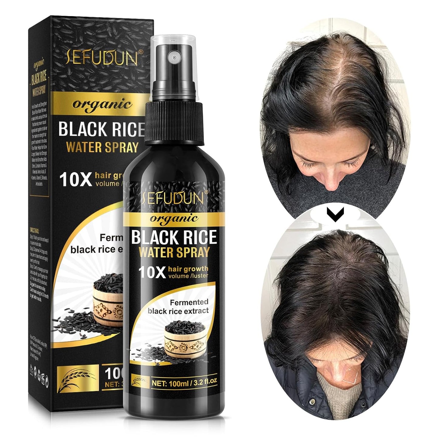 (3Pc) Organic Black Rice Water Spray for Hair Growth, A Solution with Castor Oil & Ginger Root Extract for Thicker, Fuller Hair, Targets Hair Loss and Repairs Damage 300ml/9.6 fl.oz