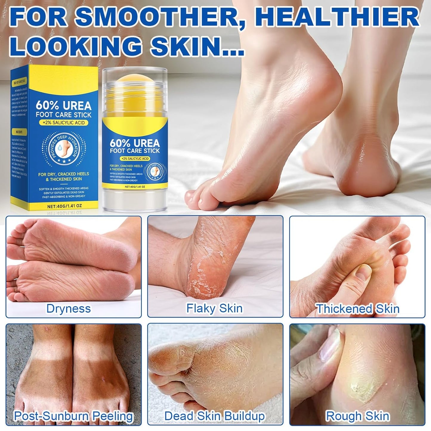 Foot Urea Cream, 60% Urea Cream for Feet Maximum Strength Repair Cracked Skin, Foot Moisturizer Nourish Cracking Rough Dry Heels, Feet Callus Remover Gel, 1.41Fl Oz