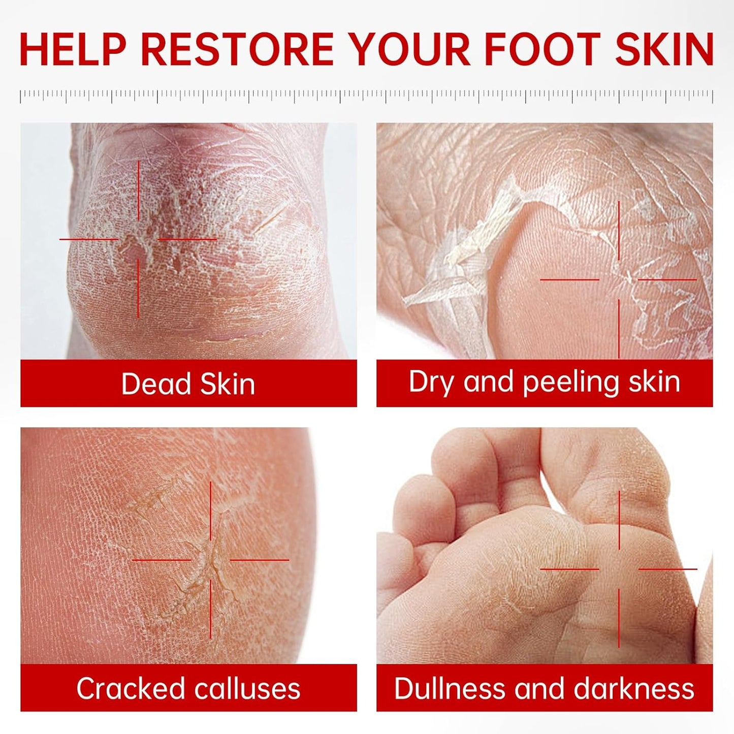 7 Pack Foot Peeling Mask, Hydrating Exfoliating Foot Mask for Dry Cracked Feet, Callus Remover & Cracked Heel Repair & Foot Care