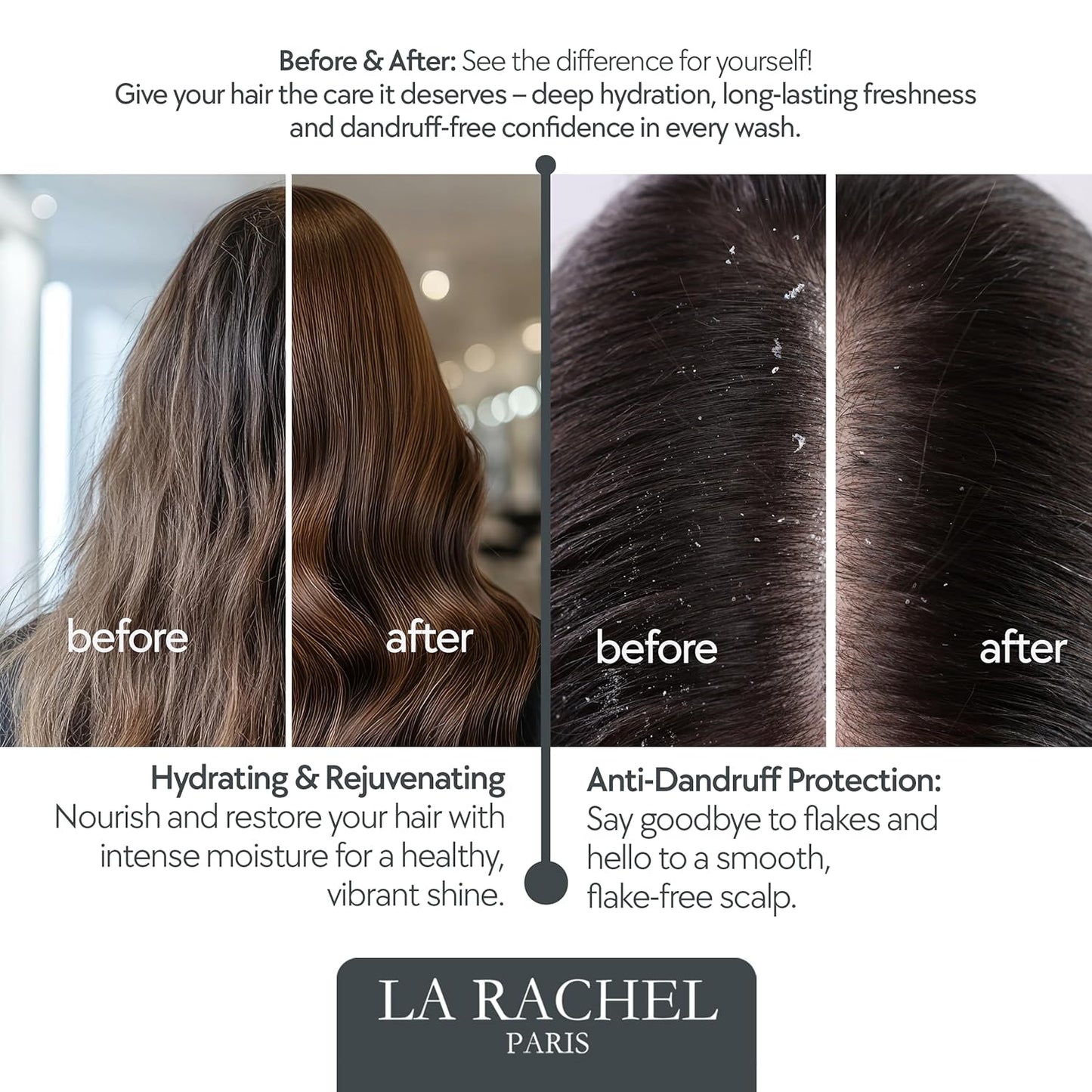 LA RACHEL 14-in-1 Hair Care Oil for Growth & Strength | Scalp & Follicle Nourishing Oil | Restores Shine & Repairs Damaged Hair for Healthier, Stronger Locks Paris | 3.4 Fl oz